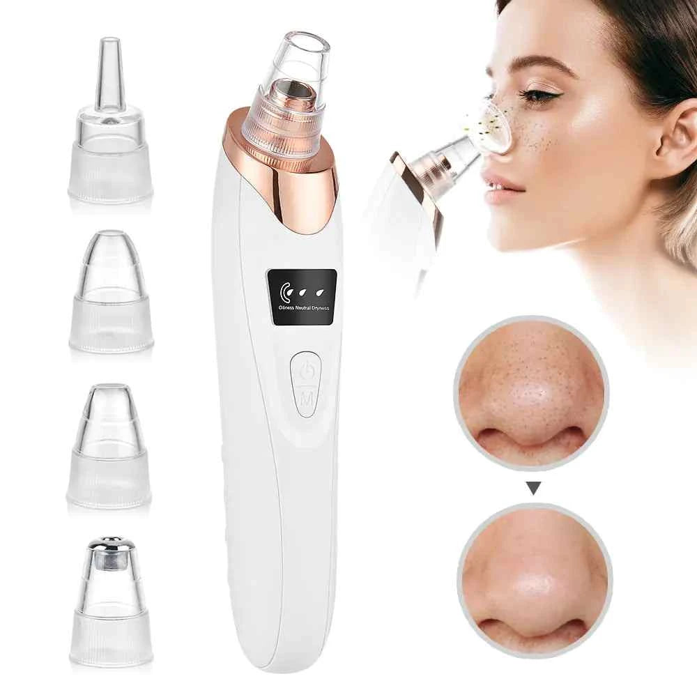 Experience flawless skin with our Beauty Electric Blackhead Remover: Effortlessly banish imperfections for a radiant complexion!