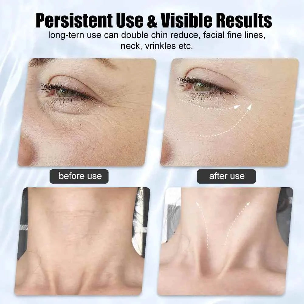Firming Wrinkle Beauty Devicer for Facial and Neck